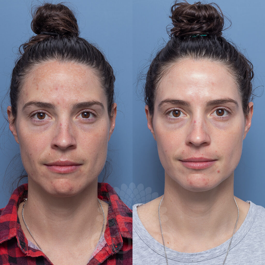 Coco Hydrate | Coco Skin Clinic