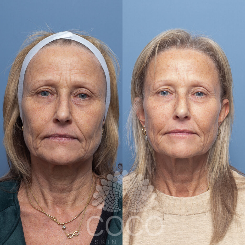 Coco Restore | Coco Skin Clinic