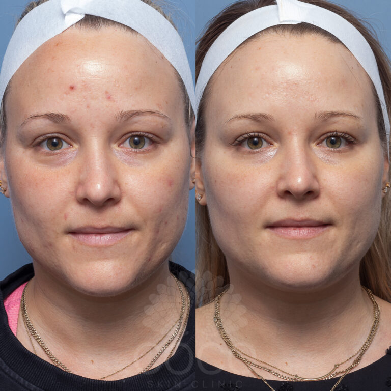 restorative treatment designed to refresh and rehydrate the skin