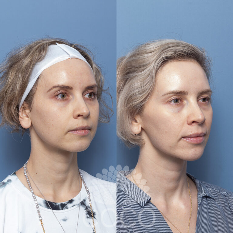 COCO Signature Facial