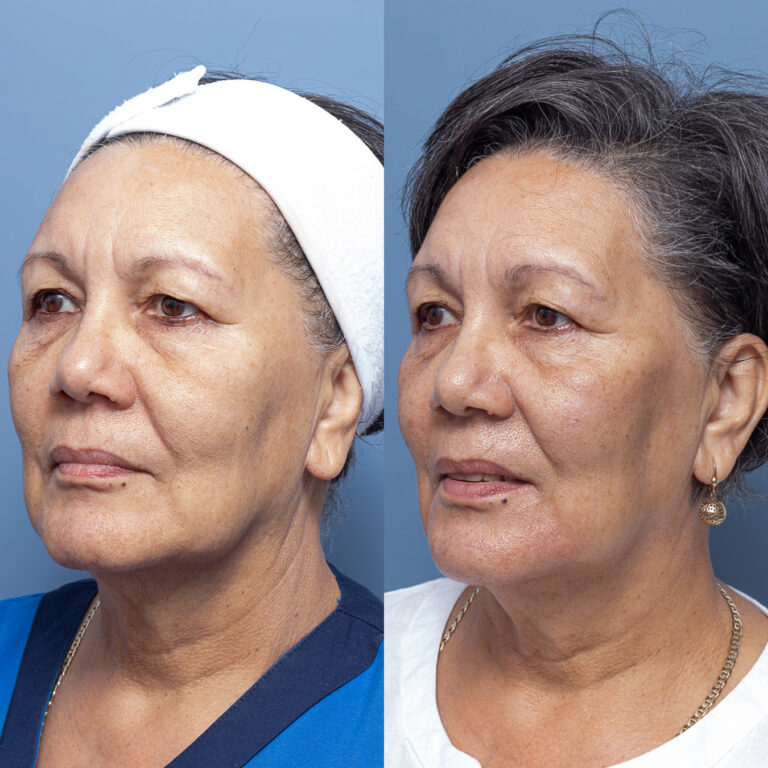 RATIONALE Skincare mask