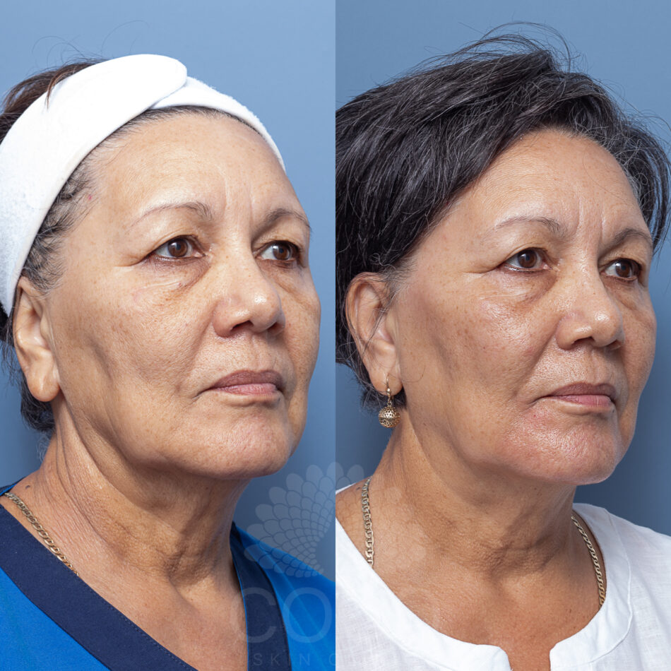 VERONICABOULLINEAU090656-BALUXE03